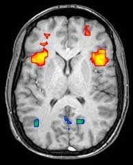 FMRI Scanning af hjerne