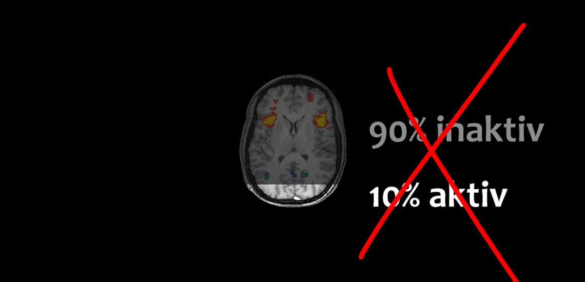 Myte: Vi bruger kun 10% af vores hjerne